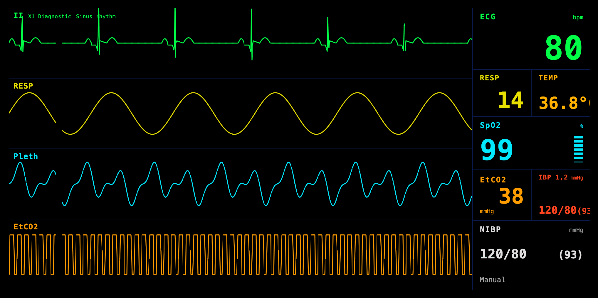 SimMan vitals